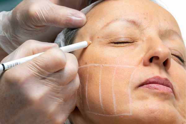 CryoPen: 5 Skin Concerns It May Be Used to Treat 4 What should you ask before having CryoPen treatment Herefordshire?