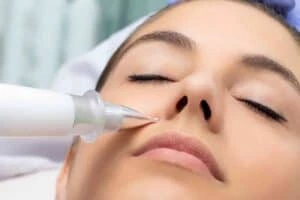 Best Actinic Keratoses Removal 3 Actinic keratoses Herefordshire solutions - book in today!